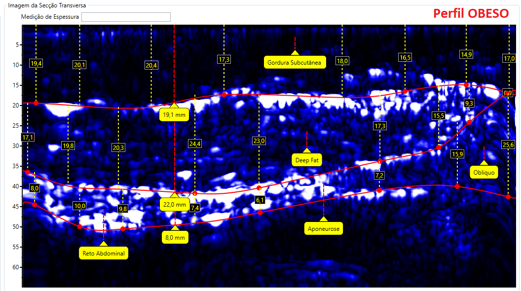 Comparativo de imagens de Abdômen