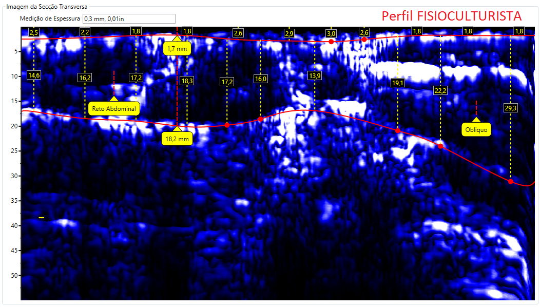 Comparativo de imagens de Abdômen