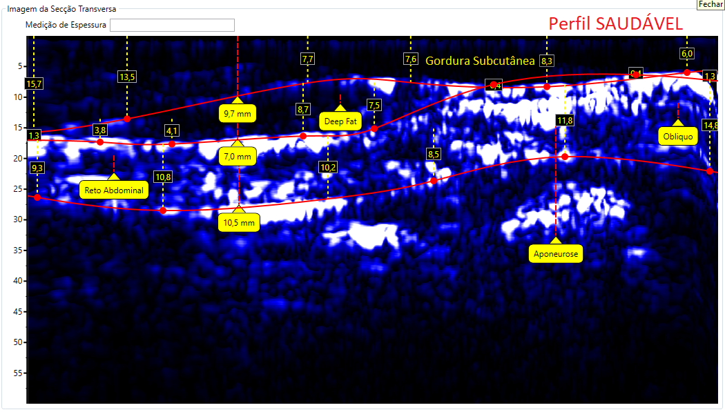 Comparativo de imagens de Abdômen
