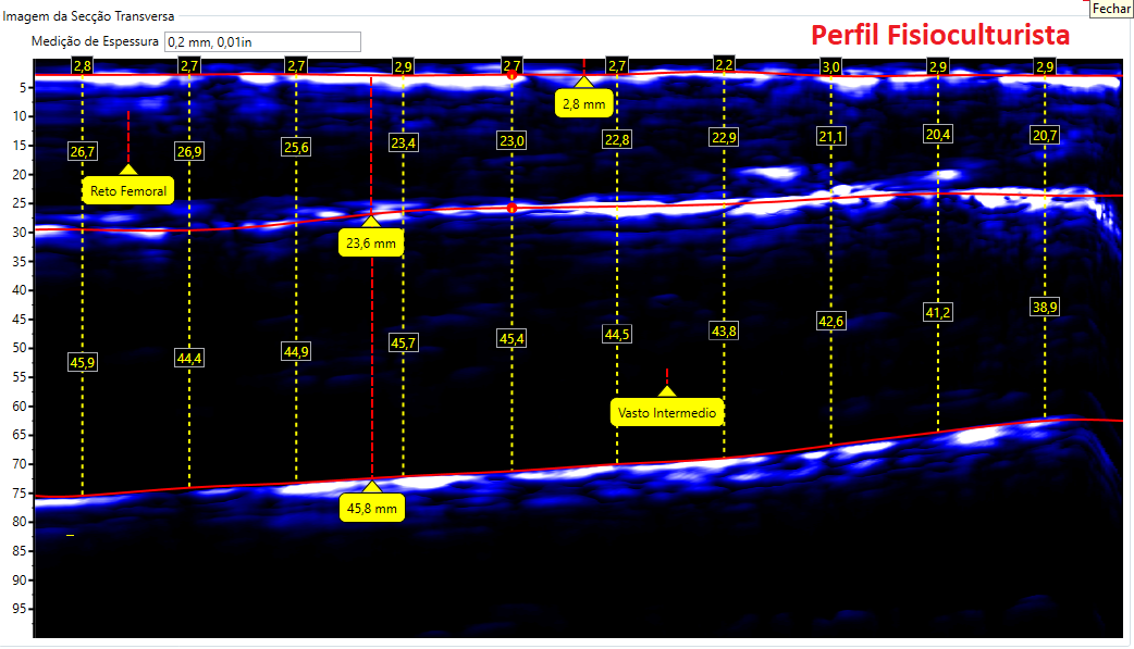 Comparativos de imagens de Coxa