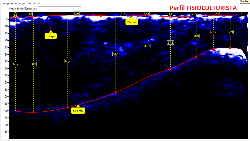 Comparativos de imagens de Tríceps