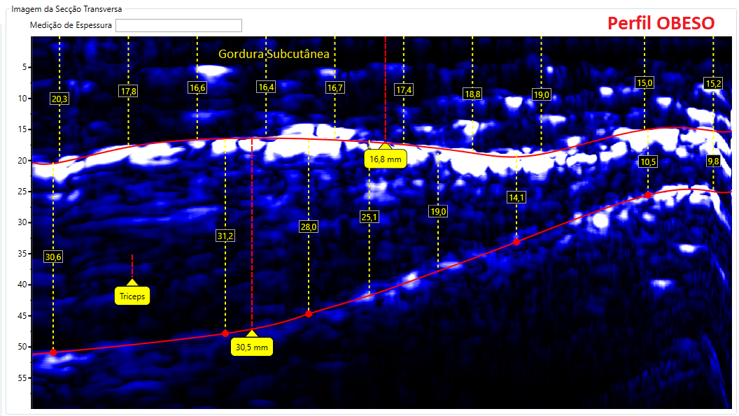 Comparativos de imagens de Tríceps