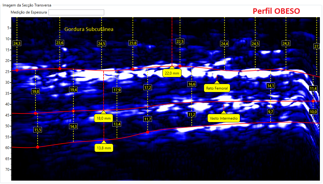 Comparativos de imagens de Coxa