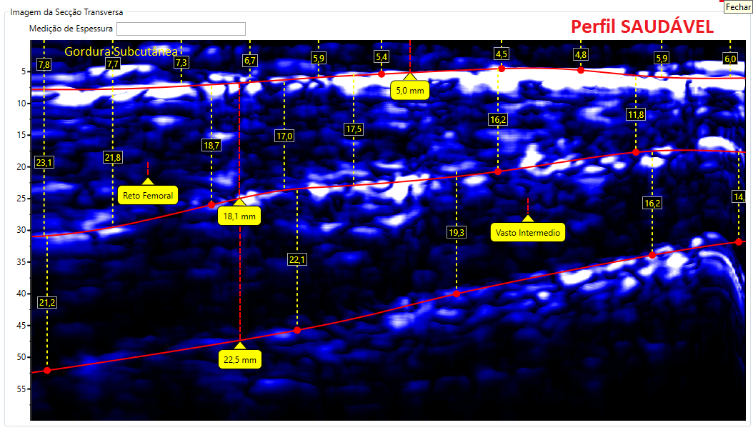Comparativos de imagens de Coxa
