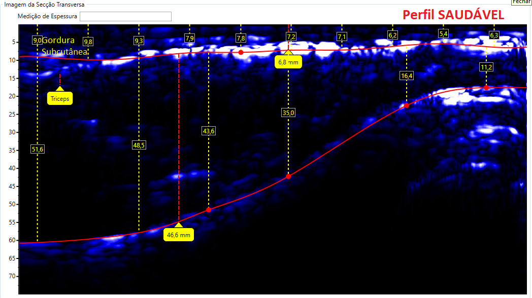 Comparativos de imagens de Tríceps