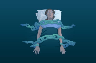 Between Dream and Reality: Demystifying Sleep Paralysis