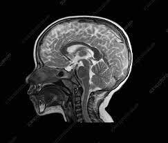 MRI: A Journey Through Time and Technology