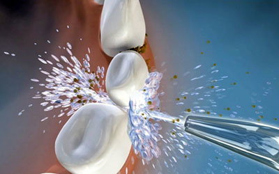 50 Estudios Independientes abalan Waterpik