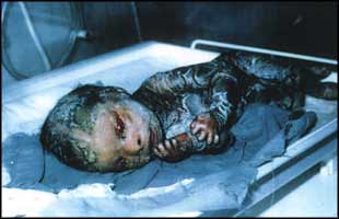 DEPLETED URANIUM