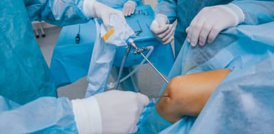 Robotic Knee Replacement