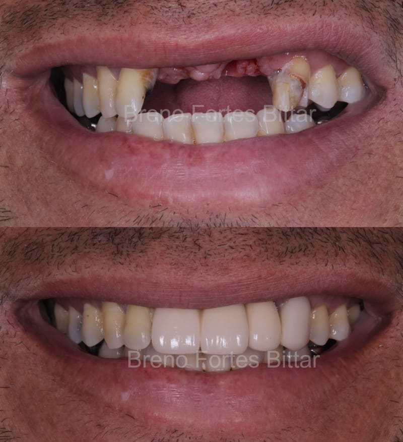 Reabilitação funcional e estética