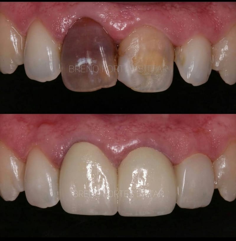 Odontologia Estética