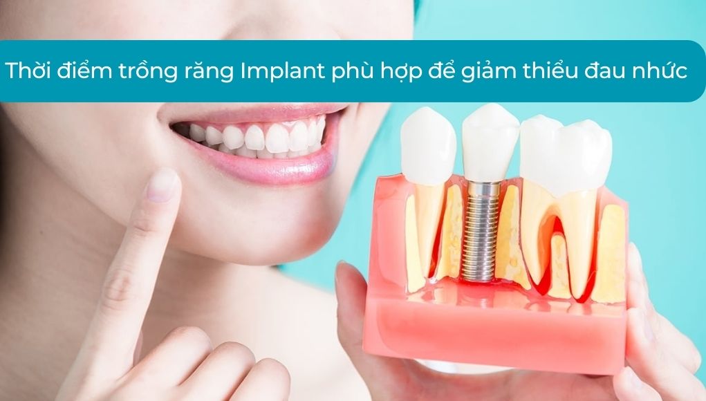 Thời điểm trồng răng Implant phù hợp để giảm thiểu đau nhức