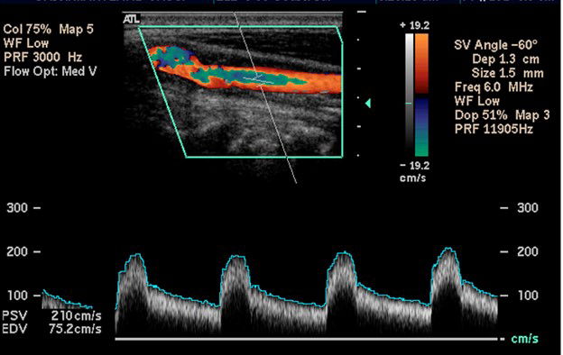 Basic Vascular Ultrasound Workshop