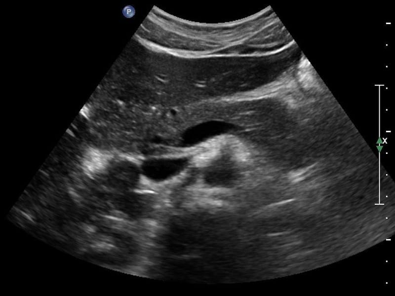 Basic Abdominal Ultrasound Workshop