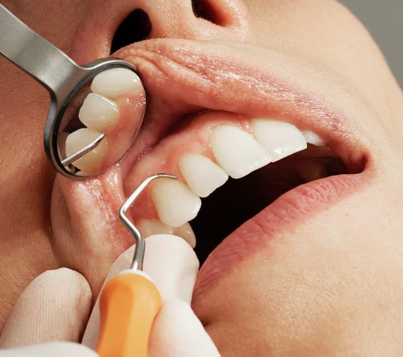 Periodontal Management