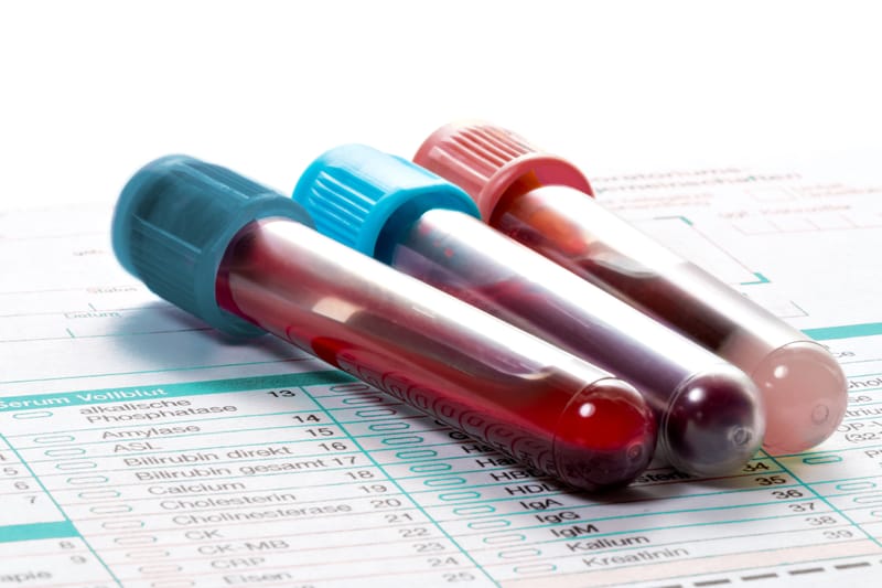 Clinical Hematology Laboratory