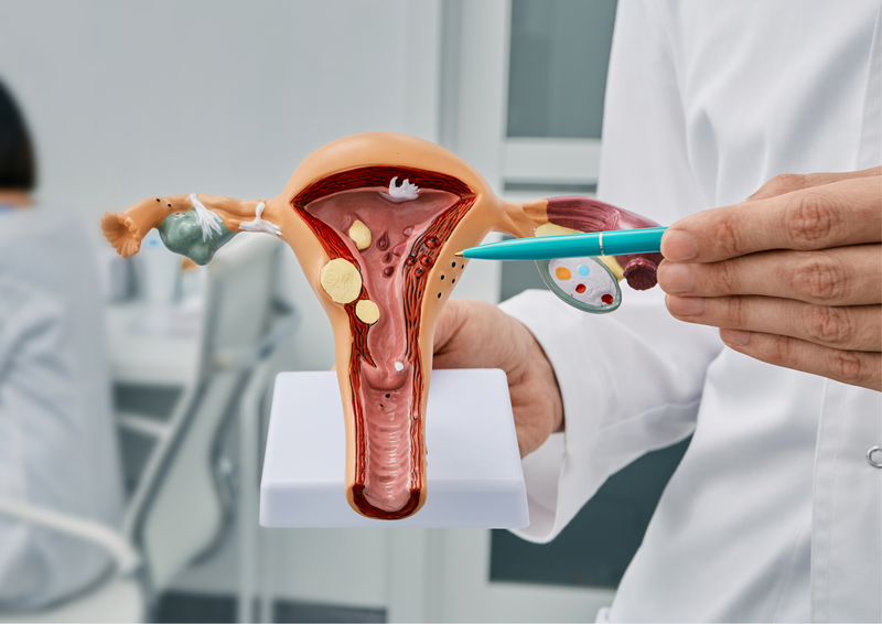 UTERINE FIBROID