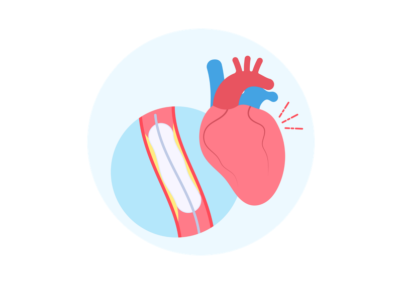 BRONCHIAL ARTERY EMBOLIZATION (BAE)