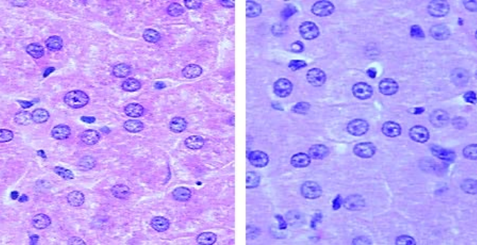 Hepatocytes