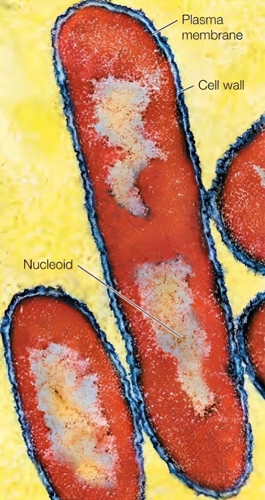 Prokaryotic cells