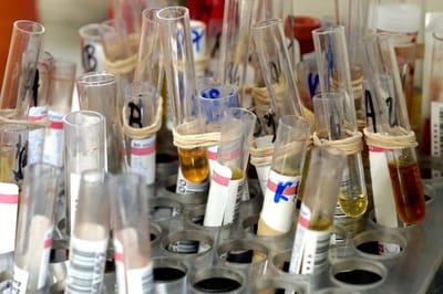 WHY DRUG TESTS ARE IMPORTANT