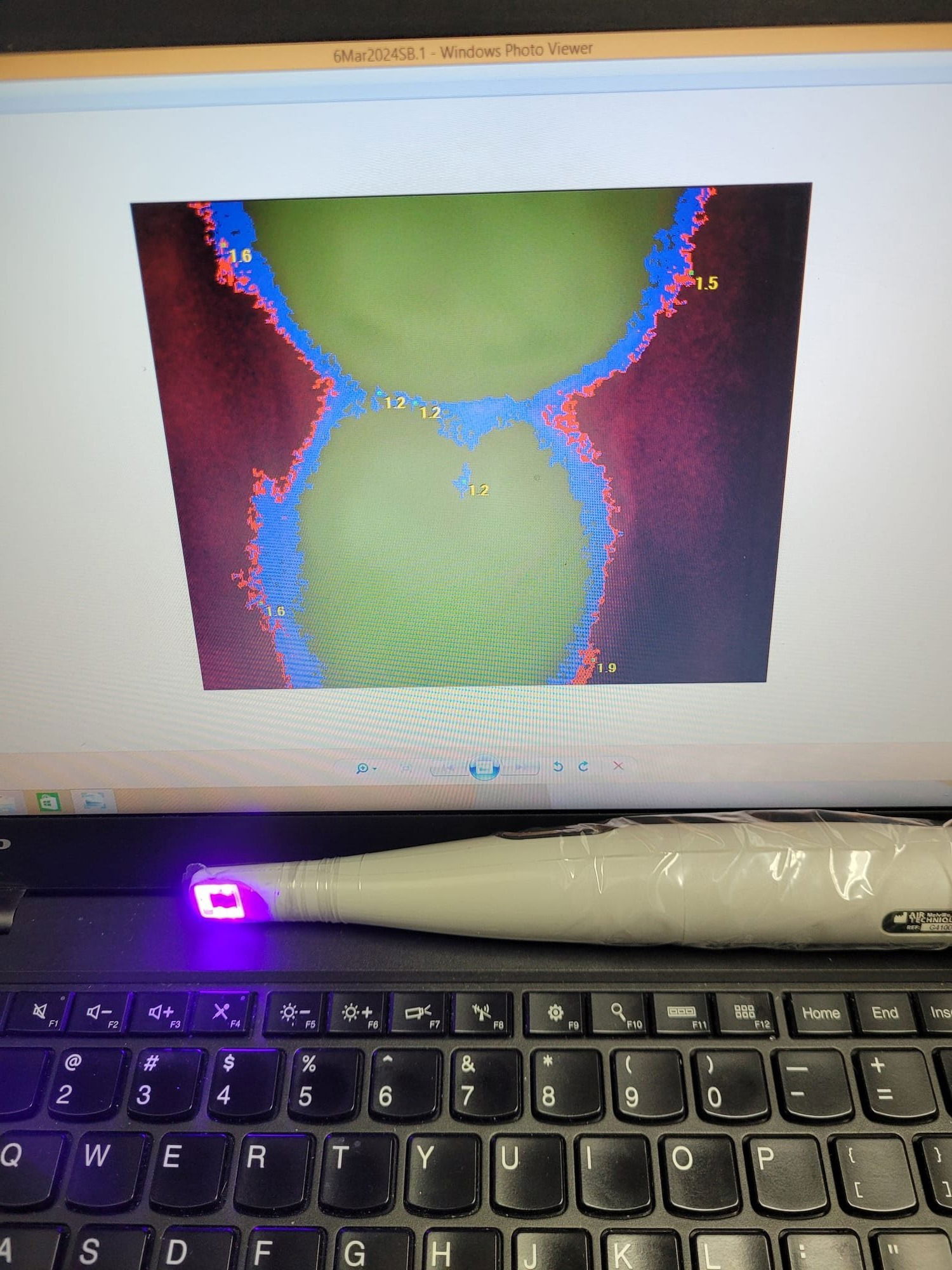 Spectra Caries Detection