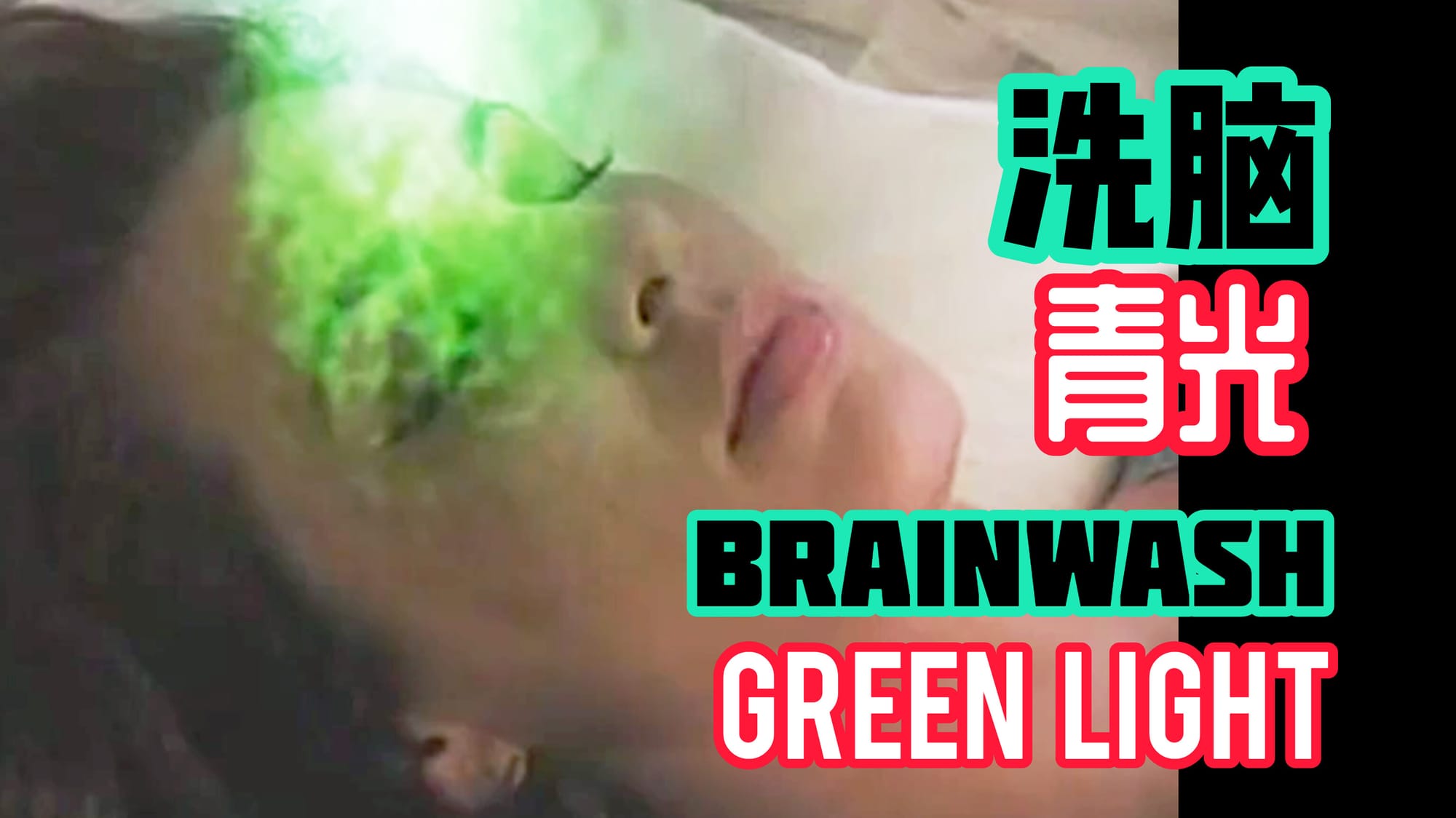 洗脑青光