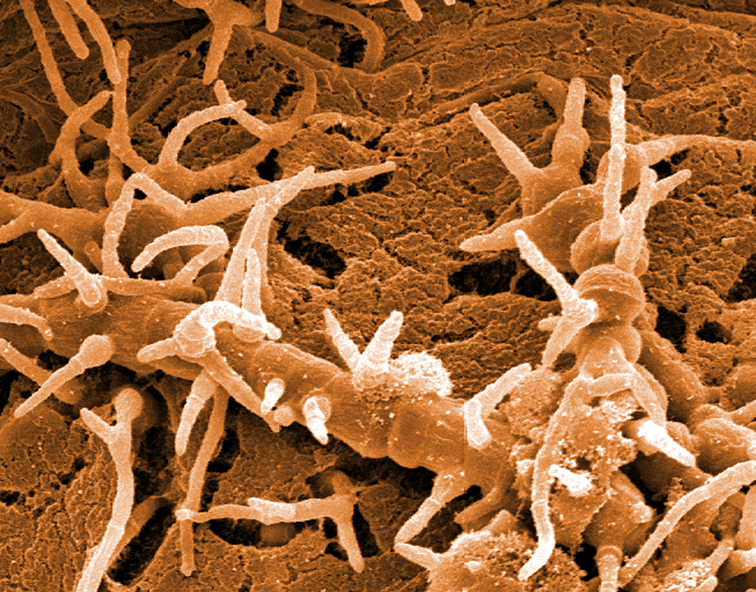 Hyphal Elongation and Branching