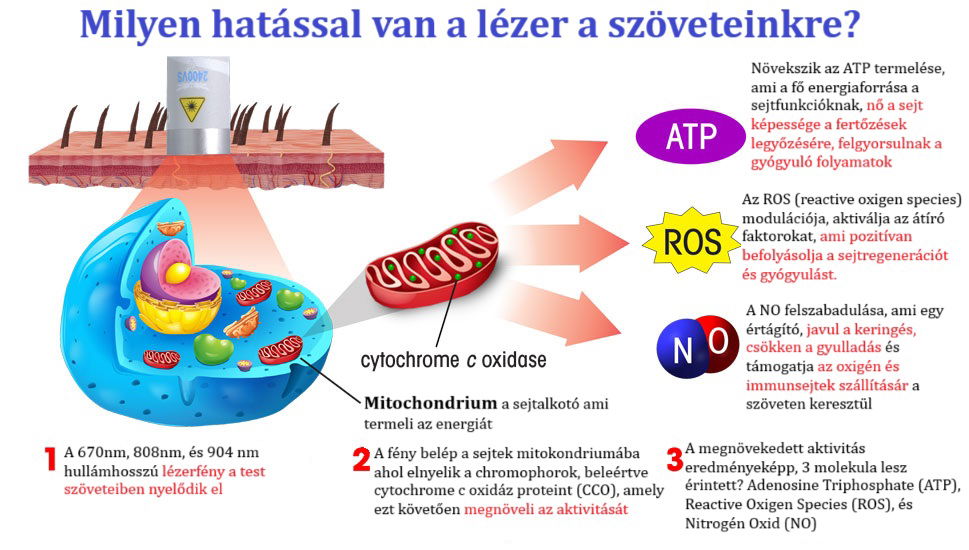 Soft lézer terápia