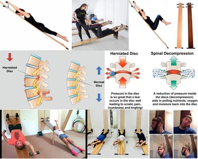 EVMINOV SPINE THERAPY