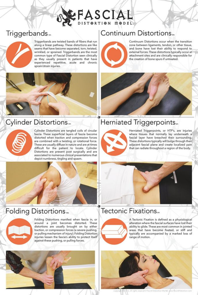 FDM (FASCIA DISTORTION MODEL) TECHNIQUE
