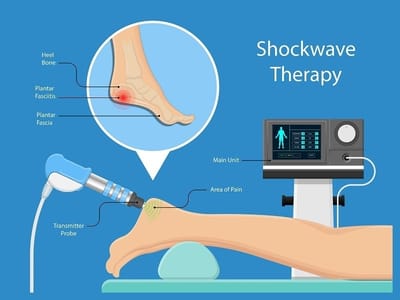 SHOCK-WAVE THERAPY