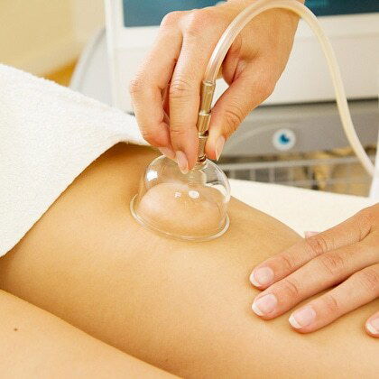 Вакуумный массаж