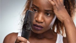 Understanding Your Hair Loss