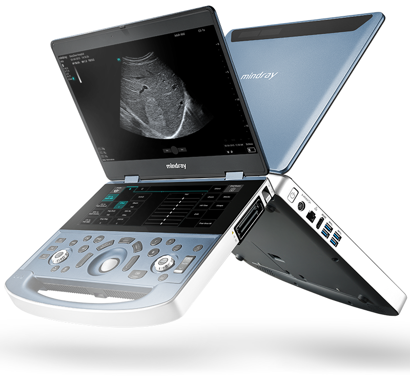 Premium Ultrasound on the GO