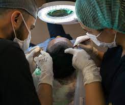 Female Hair Transplant in Dubai UAE