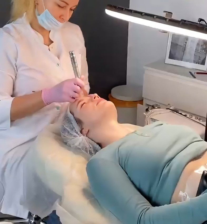 Mezoterapia mikroigłowa
