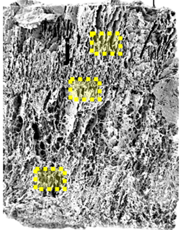 Extracellular matrix derived scaffolds for bone & joint repair