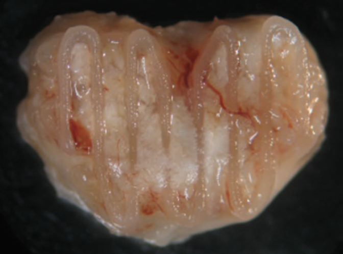 Bone & osteochondral tissue engineering