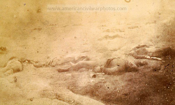 Civil War Federal dead on the field of battle of first day, Gettysburg, Pennsylvania. 1863