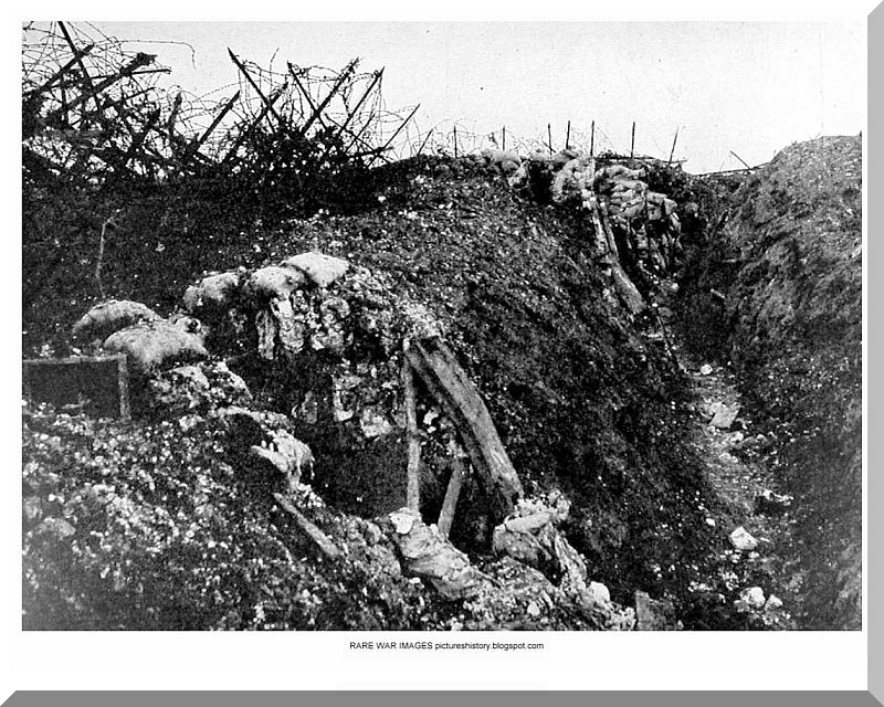 World War 1 The trenches had knives poking out from the barbwire fence