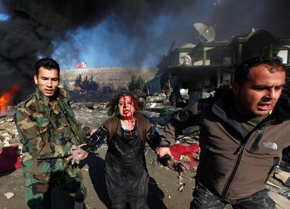 Afghanistan War December 15, 2009, A victim is taken away from the site of a bomb blast in Kabul