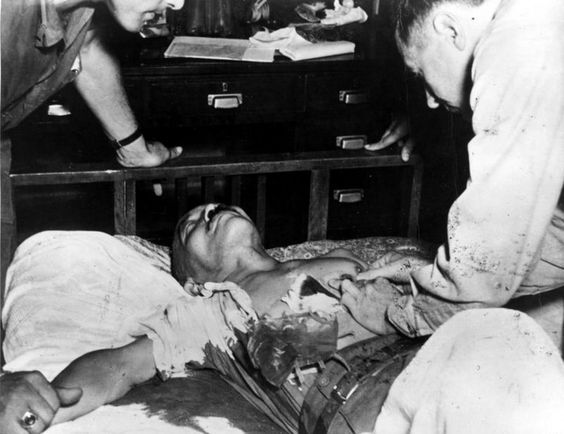 World War 2 Japanese Officer , after a failed suicide attempt.