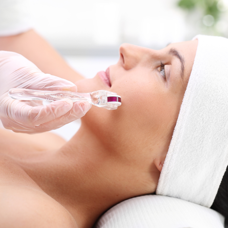 Microneedling