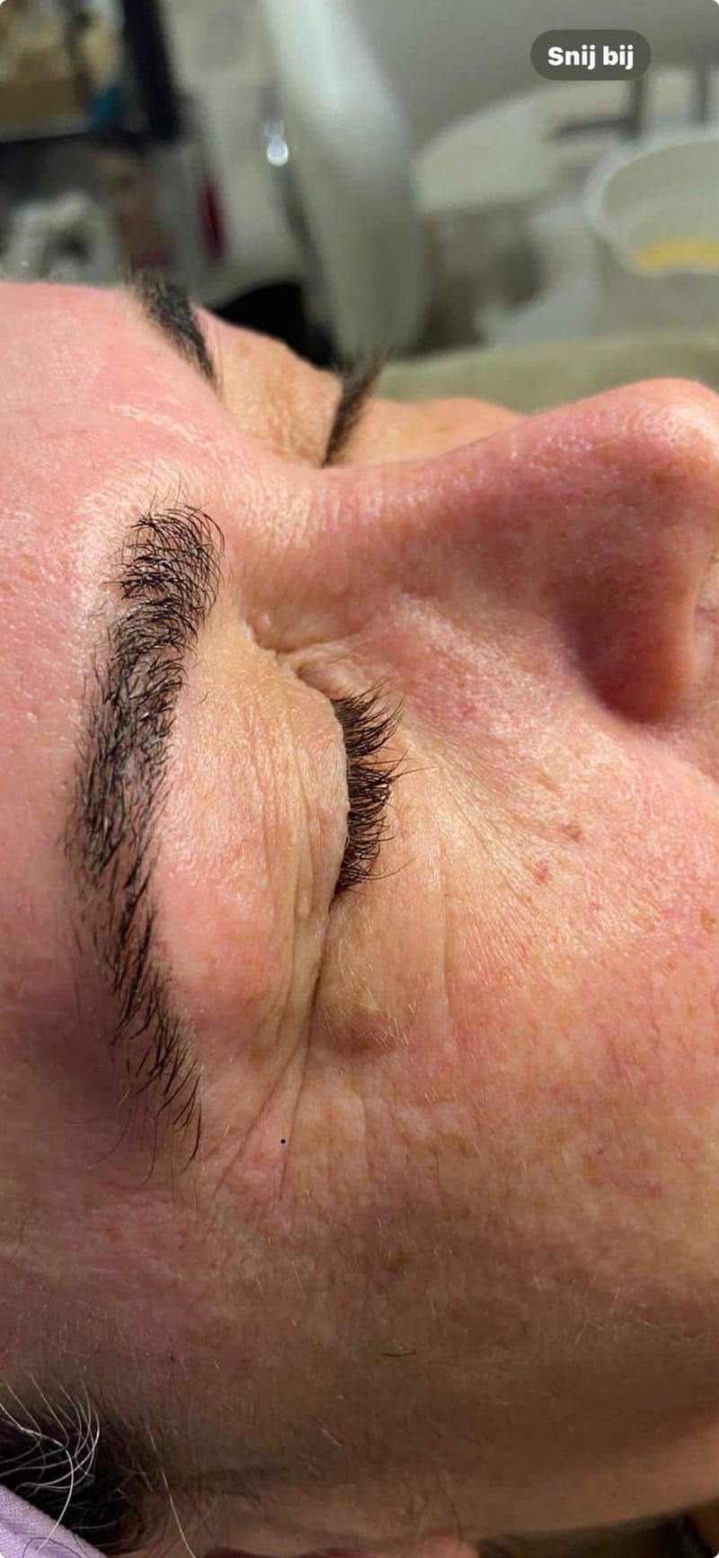 GEZICHTBEHANDELINGEN