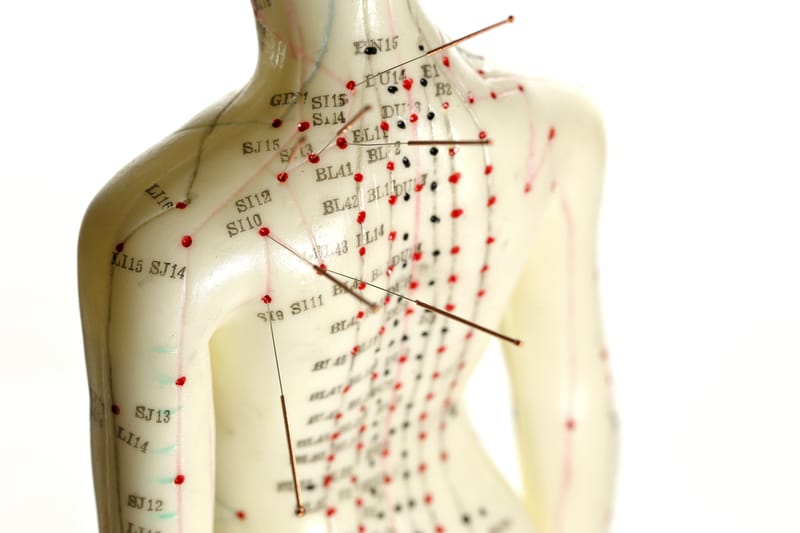 L’acupression ou l’acupuncture.