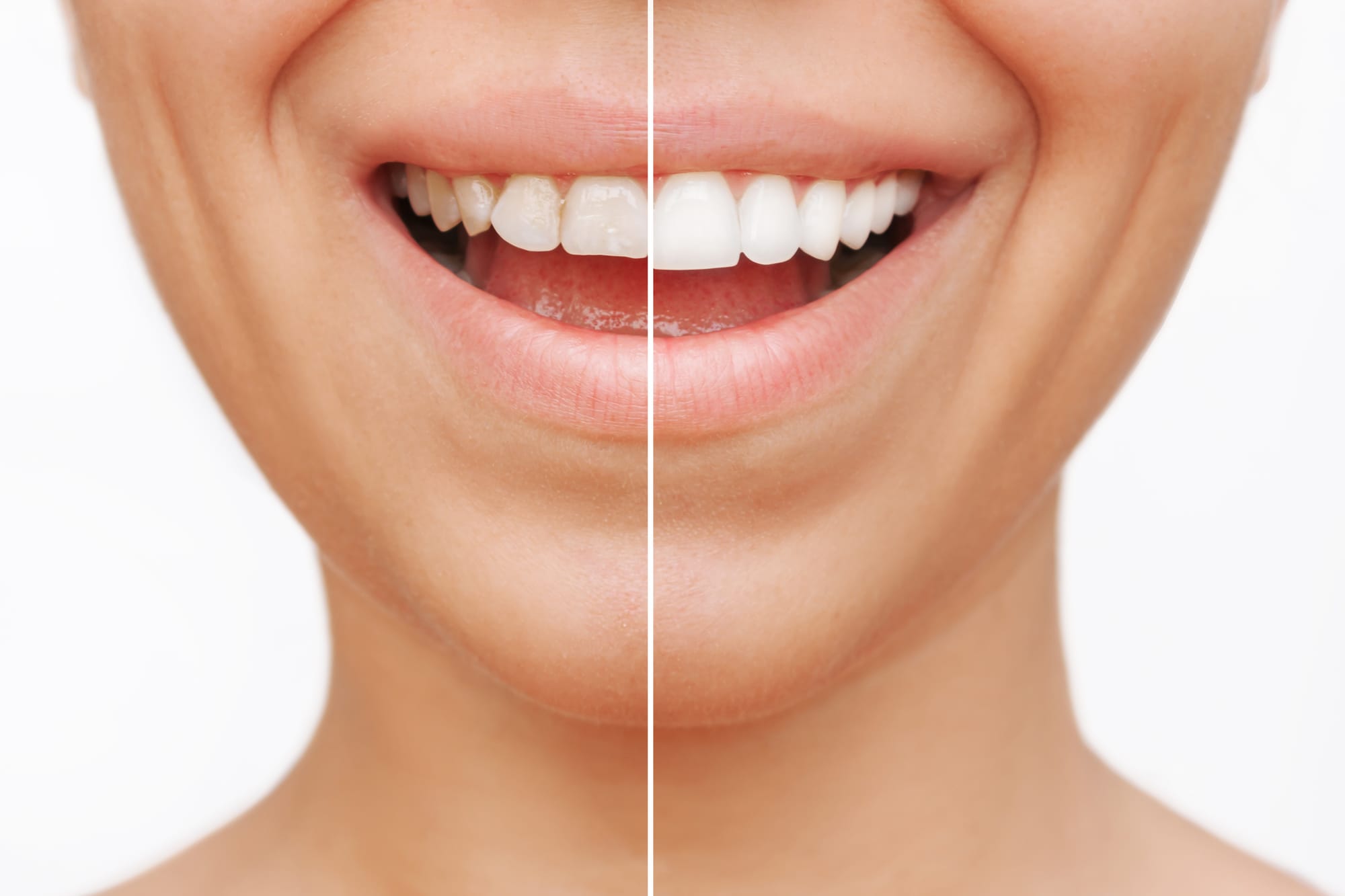 Top 10 Tips for a Radiant Smile Through Cosmetic Dentistry