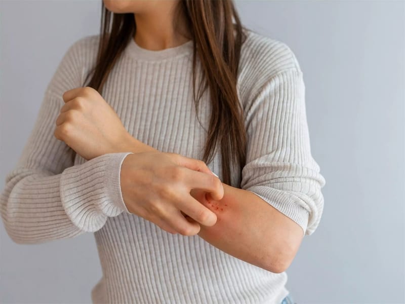 Phương Pháp Giảm Ngứa Hiệu Quả Sau Khi Triệt Lông Vĩnh Viễn