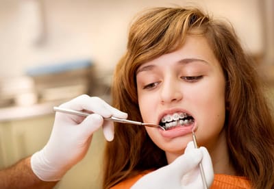 Orthodontist Calgary